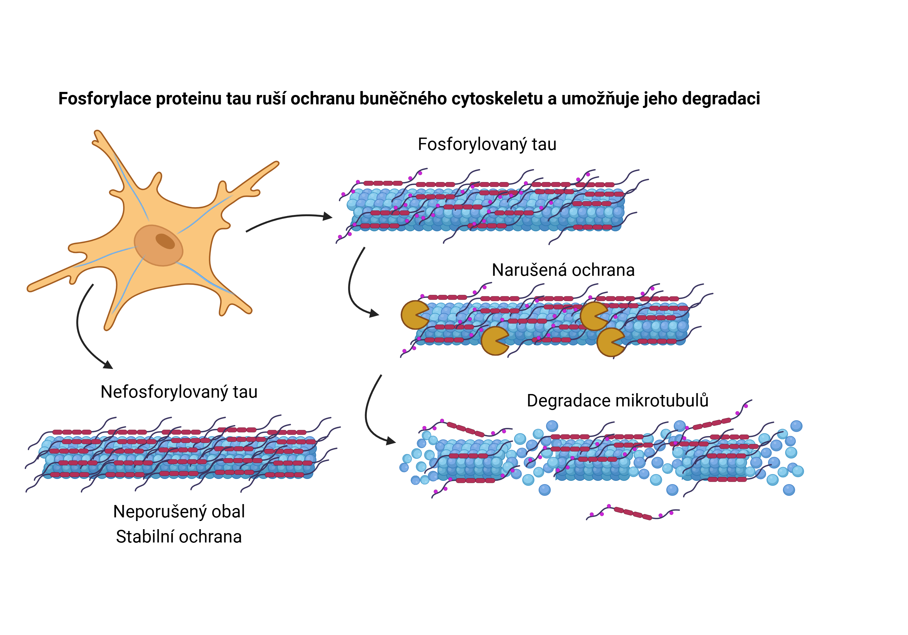 Nový pohled na ranou fázi Alzheimerovy choroby: změny v ochranném proteinu ...