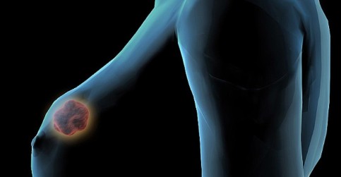 Mimořádně rychlá cesta protirakovinné látky z laboratoře ke klinickým testům Mimořádně rychlá cesta protirakovinné látky z laboratoře ke klinickým testům