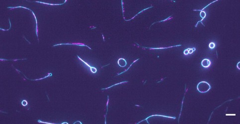 New perspective on forces that divide cells