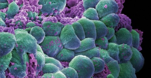 Scientists have forced cancer cells to self-destruct