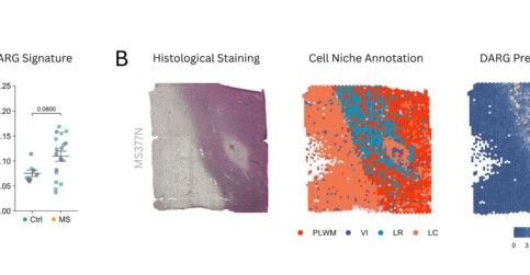 Scientists Identify Cells Driving Inflammation in Multiple Sclerosis