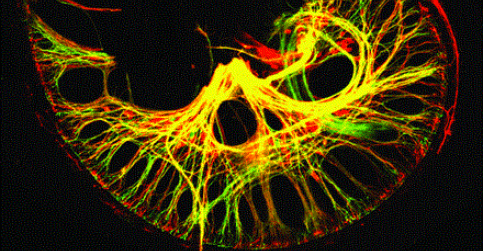 Hearing without frequencies: gene mutation detunes tonotopic organization ...