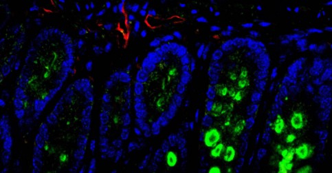 The new laboratory of IBT CAS will focus on the metabolism of healthy ...