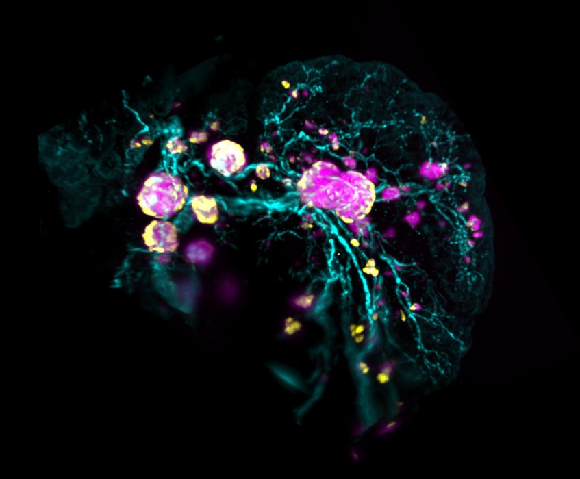 TZ diabetes_GP TZ diabetes_GP