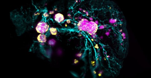 Vědci odhalili klíčový faktor ve vývoji endokrinních buněk slinivky