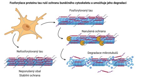 Nový pohled na ranou fázi Alzheimerovy choroby: změny v ochranném proteinu ...