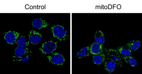 Nový protinádorový cíl: mitochondriální metabolismus železa