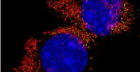 Nová role mitochondrií v nádorovém bujení
