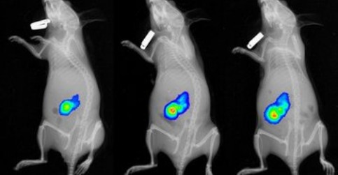 Vitamin C shows promise for the treatment of rare cancers